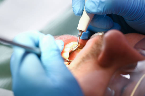 Best Weekend Emergency Dental Services in Cairo, IL
