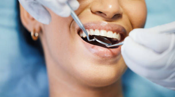 Best Emergency Denture Repair in Cairo, IL